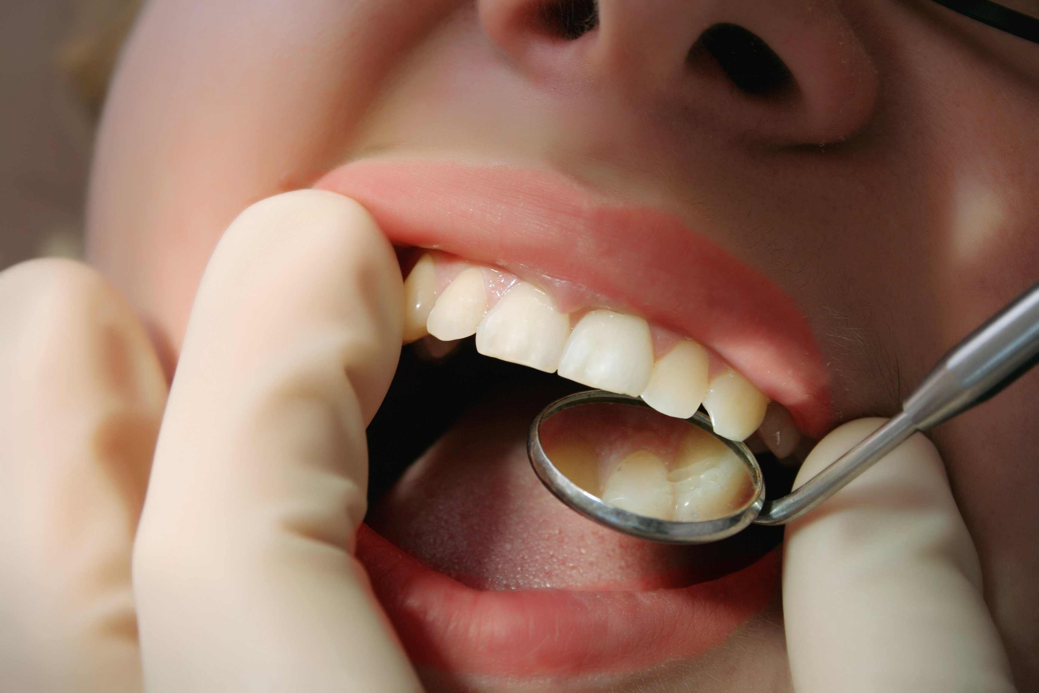 Лечение заболевшего зуба